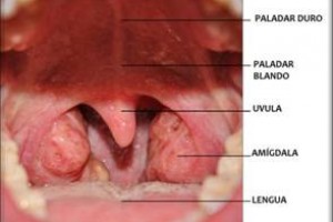 Amígdalas o amigdalectomías