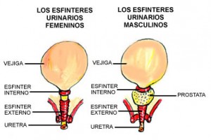 Cirugía de vejiga urinaria y vías urinaria