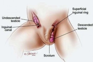 Criptorquidea