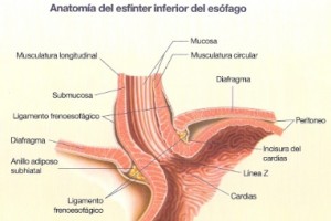 Cirugía Laparoscópica de hernia del hiato y reflujo gastroesofágico